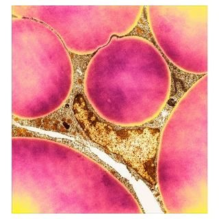 Wall Art  Posters  Fat cells, TEM Poster